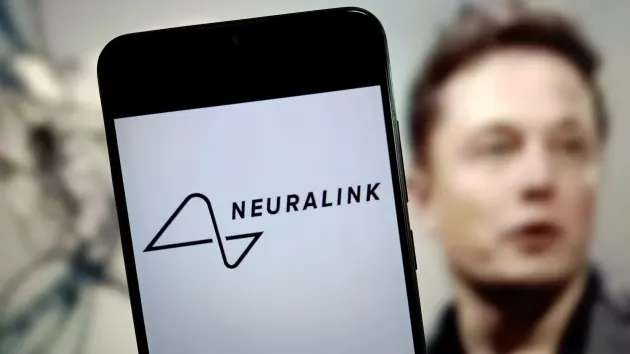 Neuralink